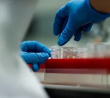 T-cell exhaustion markers