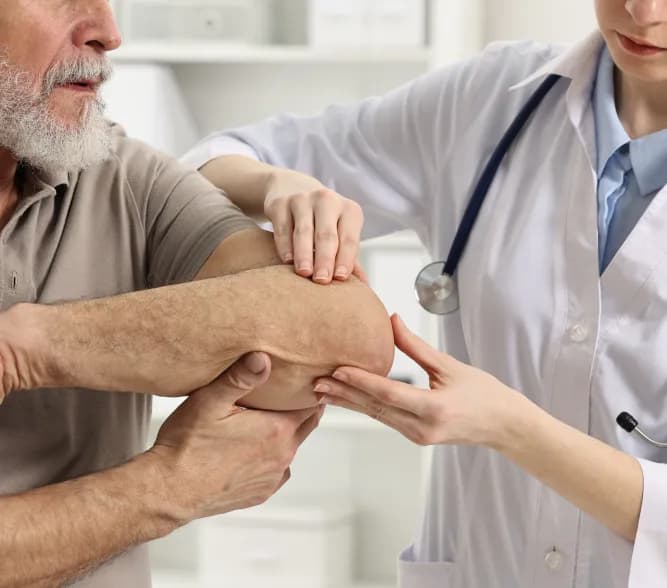 Doctor examining arthritis patient